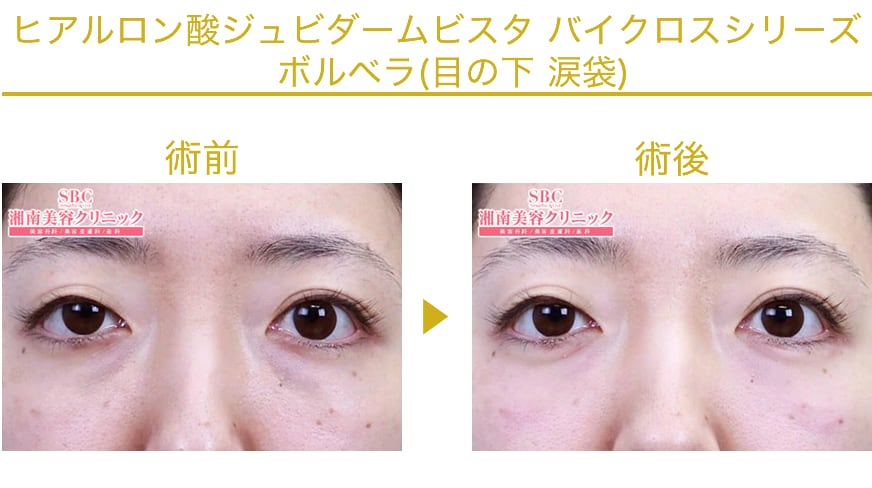 ピックアップ症例写真