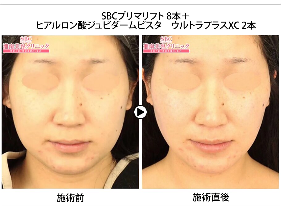 皮膚科統括医による若返りモニター 若返り 若返りモニター募集 美容整形 美容外科の湘南美容クリニック