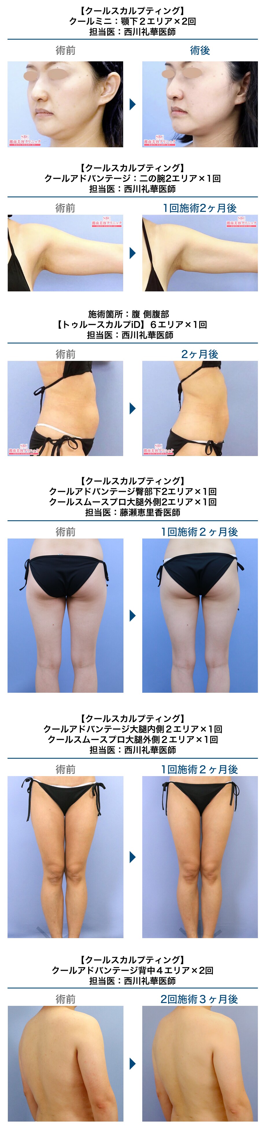 美容皮膚科医があなたにぴったりの医療ダイ 医療ダイエットモニター募集 美容整形 美容外科の湘南美容クリニック