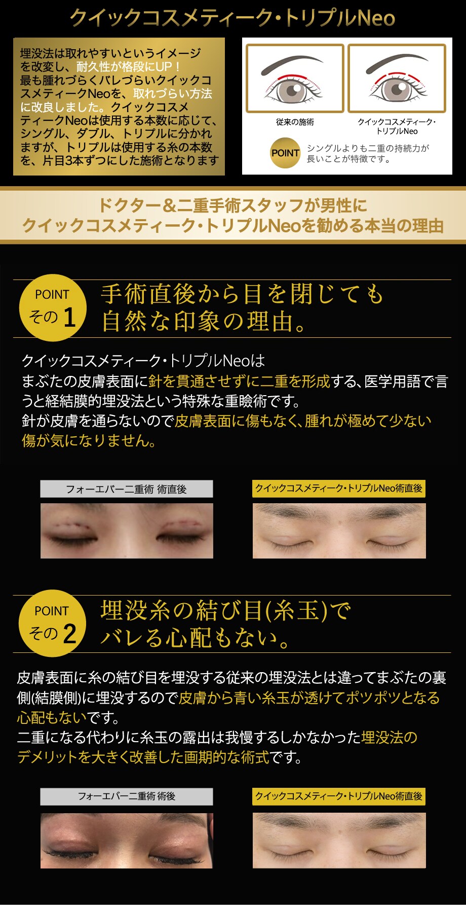 施術