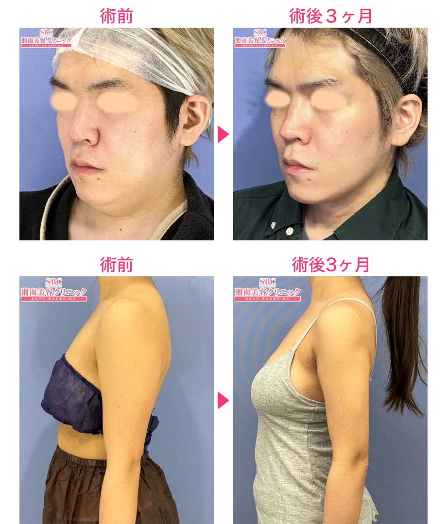 ピックアップ症例写真