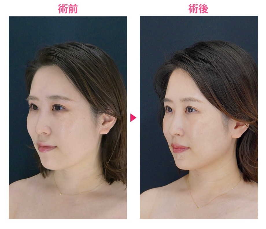 ピックアップ症例写真
