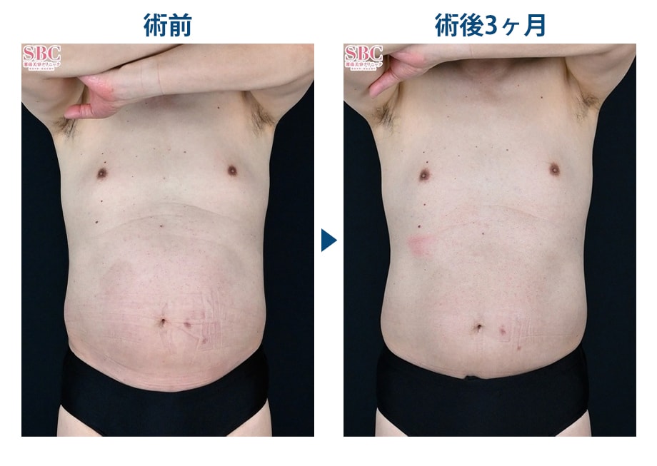 ピックアップ症例写真