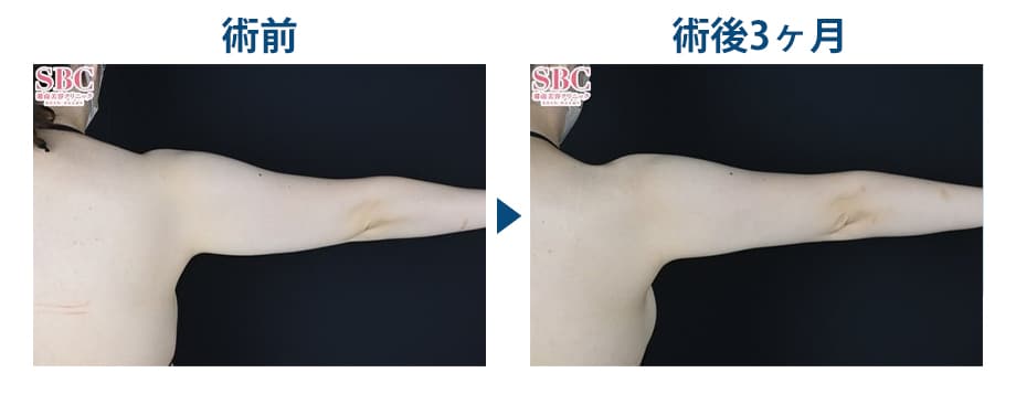 ピックアップ症例写真