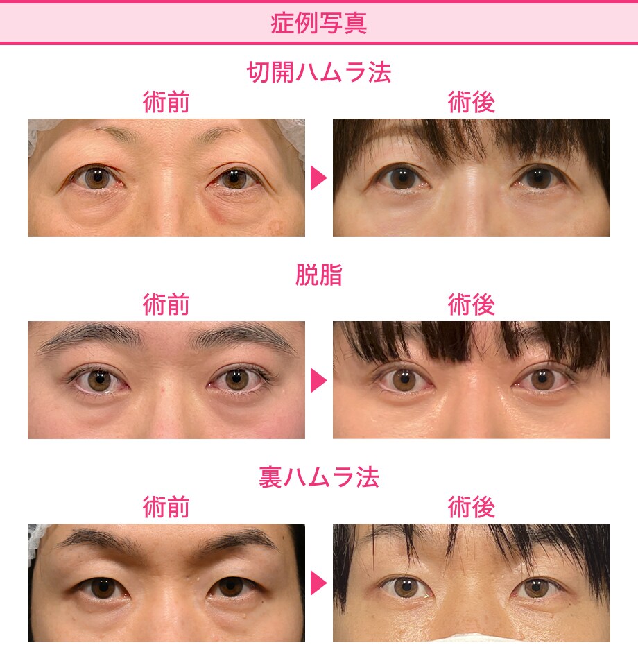 料金下症例写真