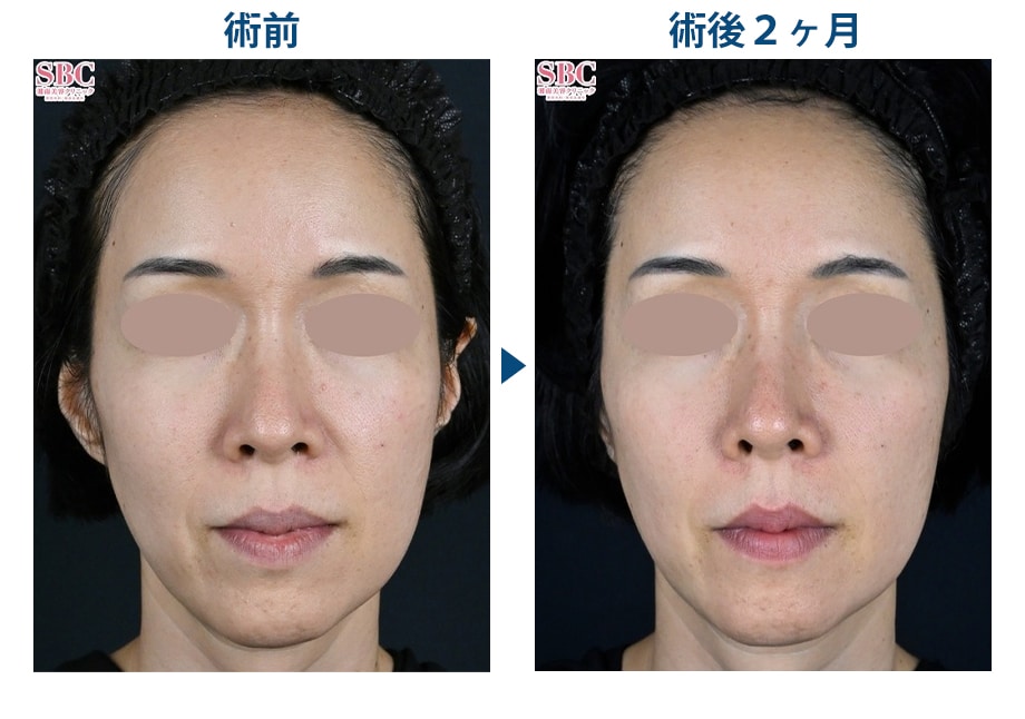 ピックアップ症例写真