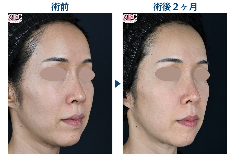 ピックアップ症例写真