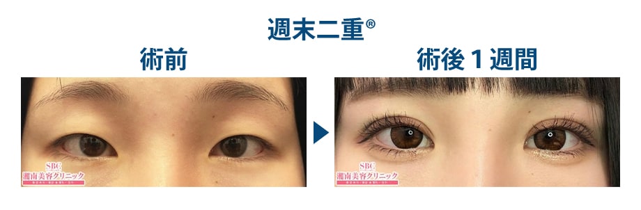 ピックアップ症例写真