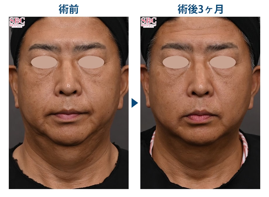 ピックアップ症例写真