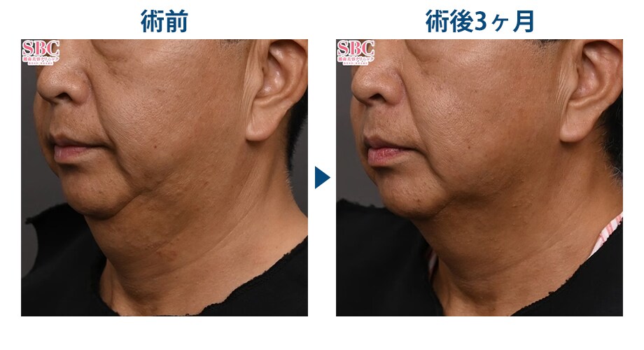 ピックアップ症例写真