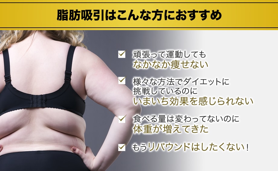 女医の丁寧で緻密な脂肪吸引 お顔 身体で 脂肪吸引モニター募集 美容整形 美容外科の湘南美容クリニック 女医の丁寧で緻密な脂肪吸引 お顔 身体で 脂肪吸引モニター募集 美容整形 美容外科の湘南美容クリニック
