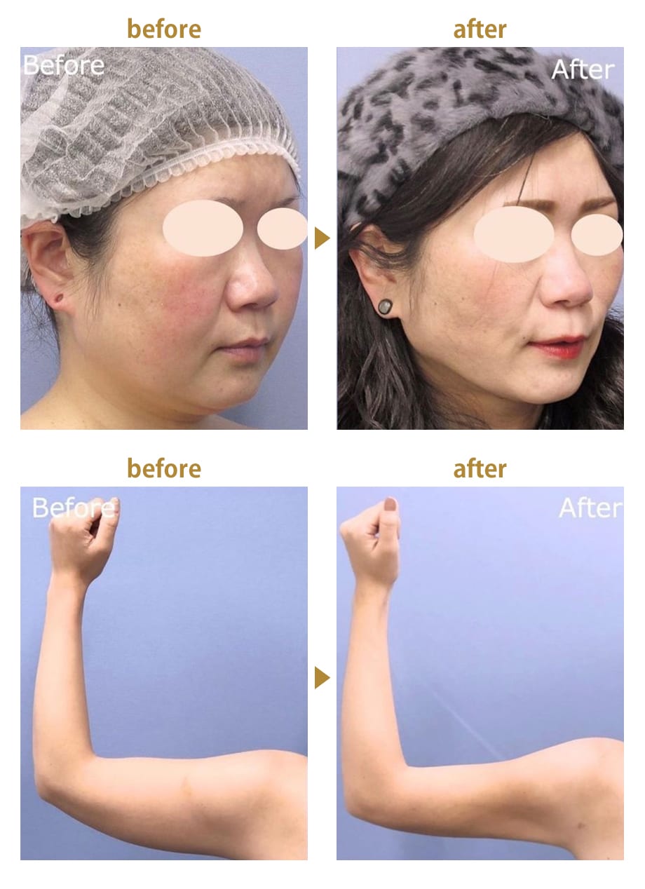 ピックアップ症例写真