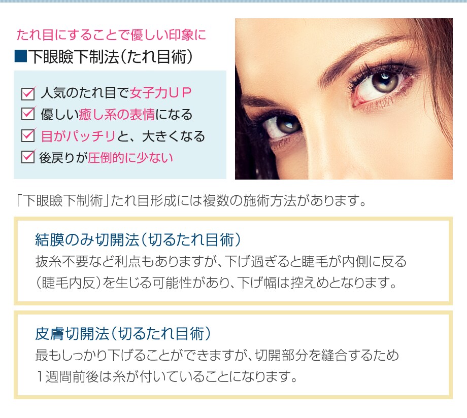 Sbc公式二重術オススメdr 選出 豊 二重 二重整形モニター募集 美容整形 美容外科の湘南美容クリニック Sbc公式二重術オススメdr 選出 豊 二重 二重整形モニター募集 美容整形 美容外科の湘南美容クリニック