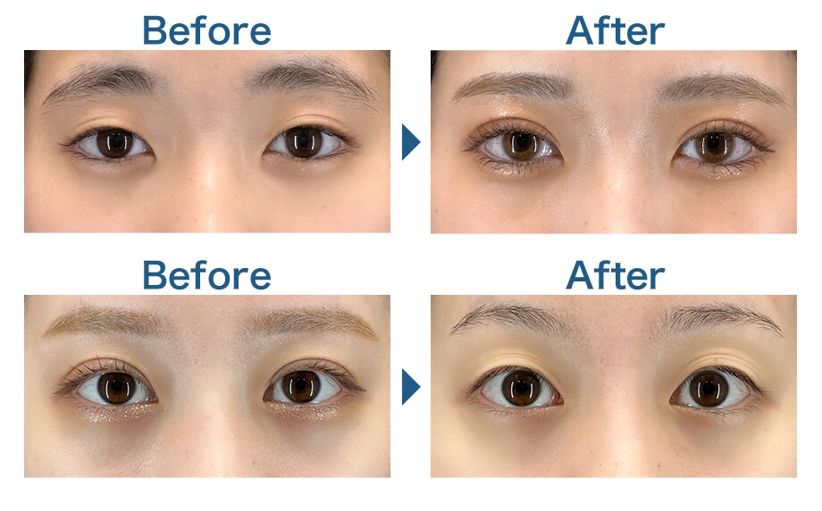 before-after