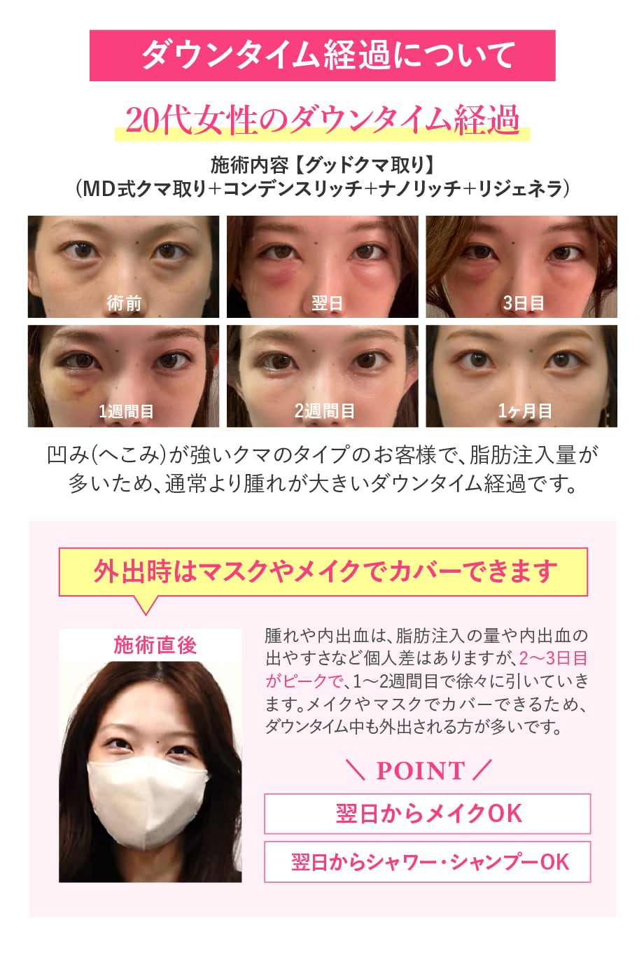 ダウンタイム経過について