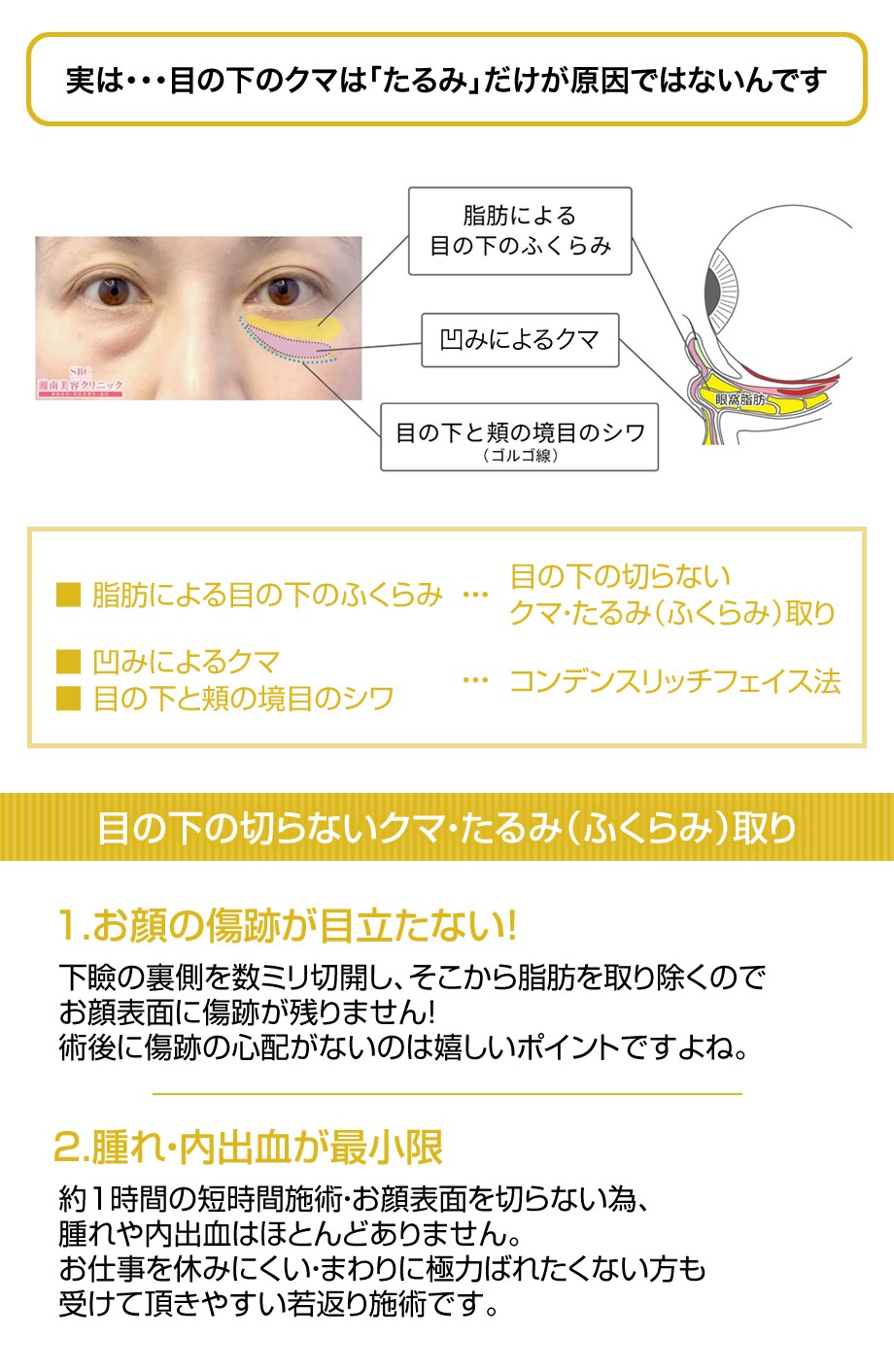 Instagramを見た で指名多数 若返りモニター募集 美容整形 美容外科の湘南美容クリニック