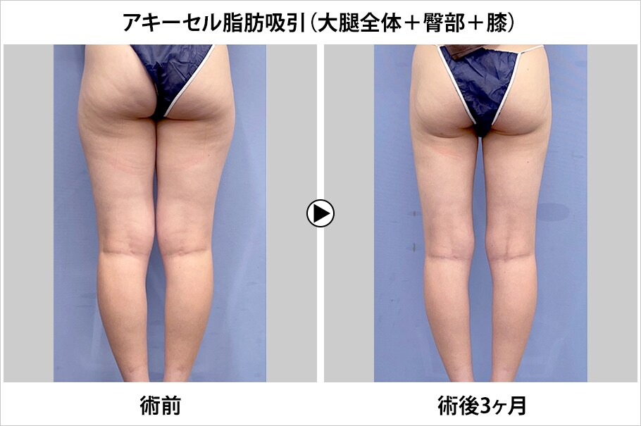 メイン下