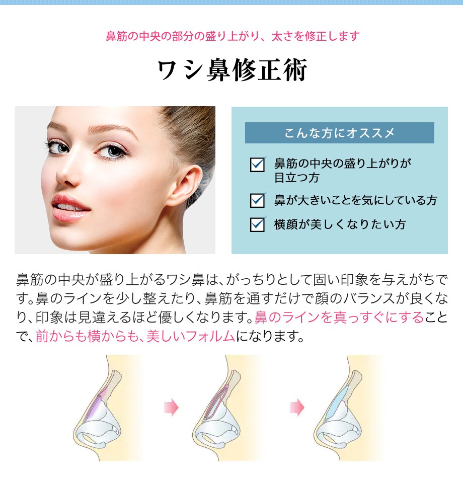 鼻施術症例数関東1位の人気 上半 鼻整形モニター募集 美容整形 美容外科の湘南美容クリニック