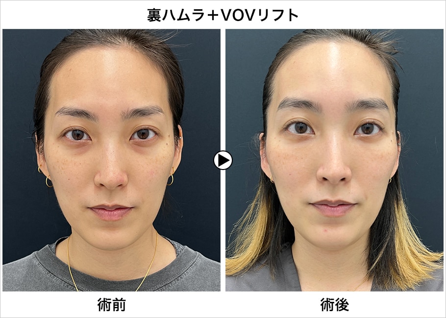 メイン下症例写真