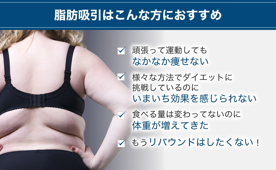 ベイザー脂肪吸引症例数全国1位 2 脂肪吸引モニター募集 美容整形 美容外科の湘南美容クリニック ベイザー脂肪吸引症例数全国1位 2 脂肪吸引モニター募集 美容整形 美容外科の湘南美容クリニック