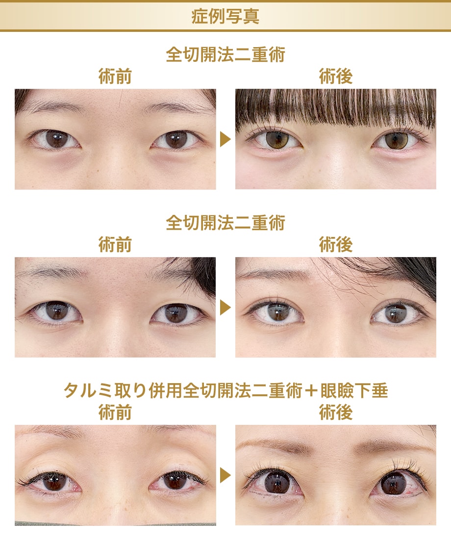 料金下症例写真