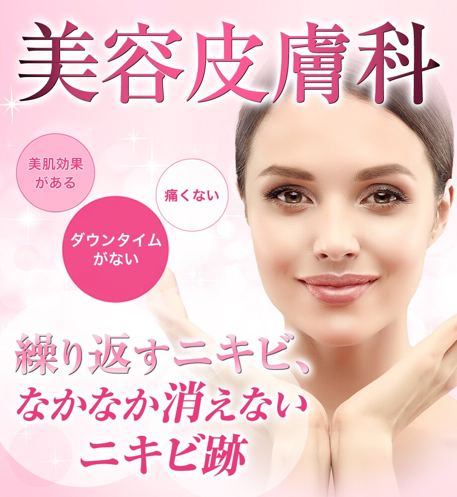 モニター募集