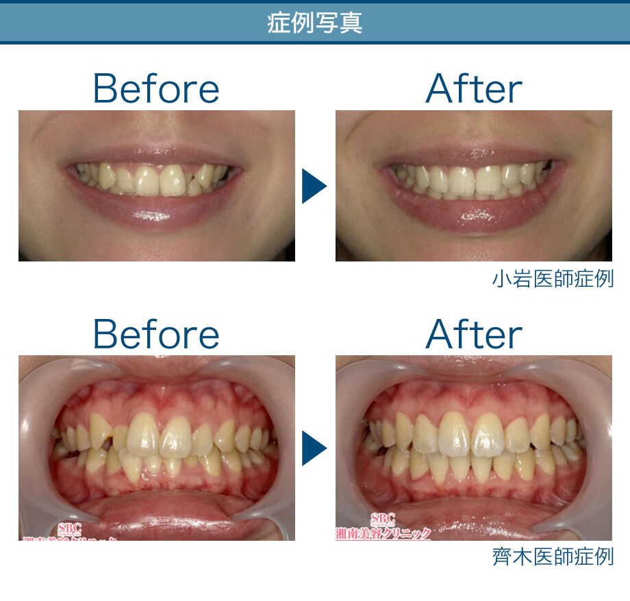 Sbc内で圧倒的症例数 歯科横浜院のマウ 美容歯科モニター募集 美容整形 美容外科の湘南美容クリニック