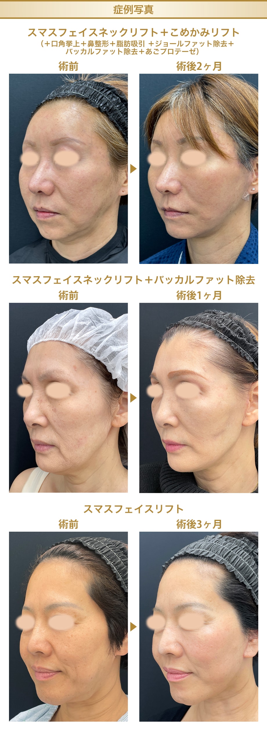 症例写真