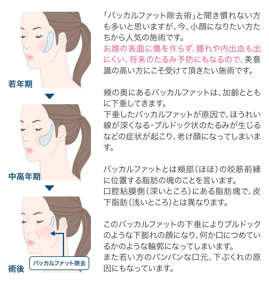 シャープなフェイスライン 脂肪吸引で理 フェイスラインモニター募集 美容整形 美容外科の湘南美容クリニック シャープなフェイスライン 脂肪吸引で理 フェイスラインモニター募集 美容整形 美容外科の湘南美容クリニック