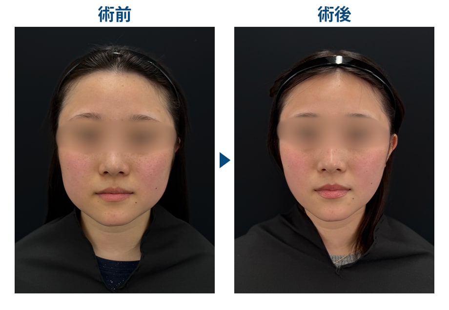 ピックアップ症例写真