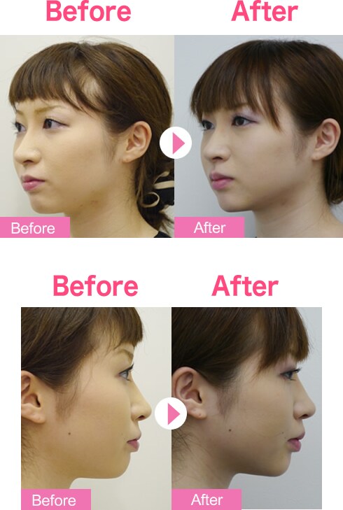 スタッフも引き締め効果 肌のうるおい つ 若返りモニター募集 美容整形 美容外科の湘南美容クリニック