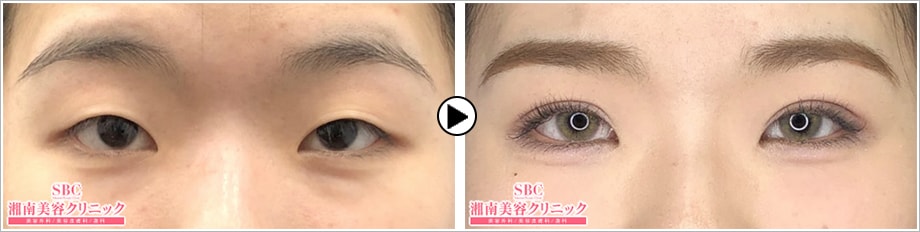 ベストコレクション 湘南 美容 外科 ナチュラル ベーシック 2498 Mbaheblogjpnqtk ベストコレクション 湘南 美容 外科 ナチュラル ベーシック 2498 Mbaheblogjpnqtk
