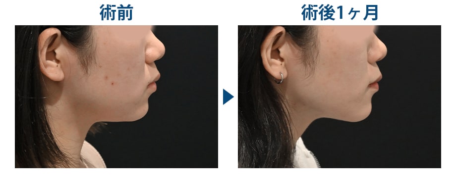 ピックアップ症例写真