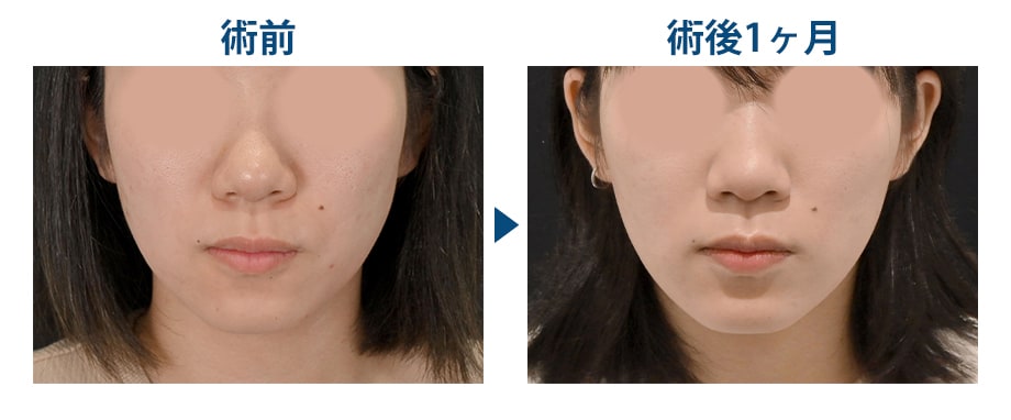 ピックアップ症例写真