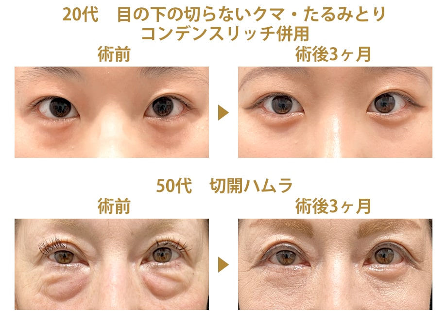 ピックアップ症例写真