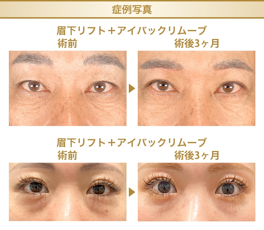 料金下症例写真