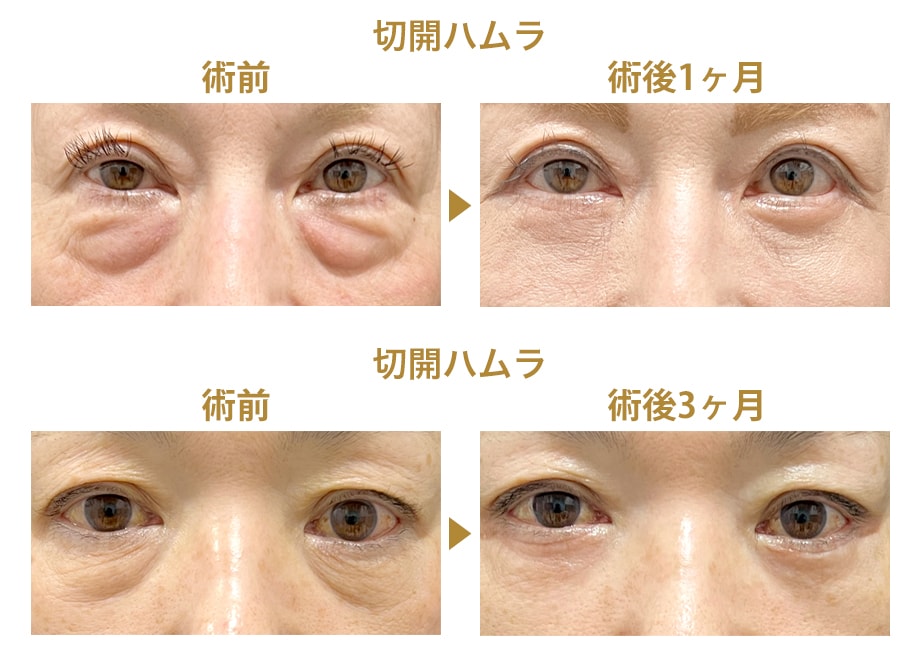 ピックアップ症例写真