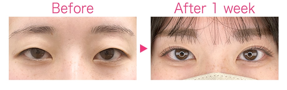 ピックアップ症例写真