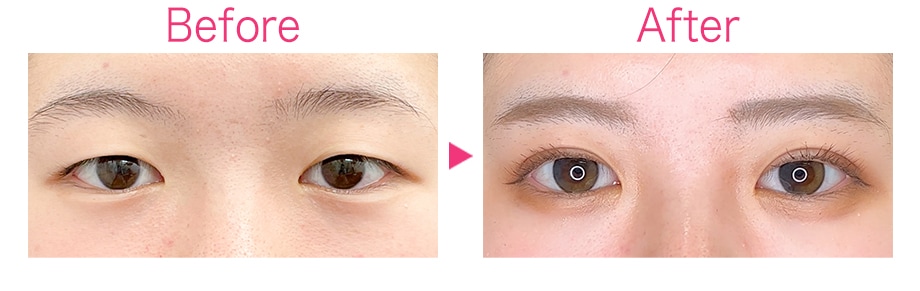 ピックアップ症例写真