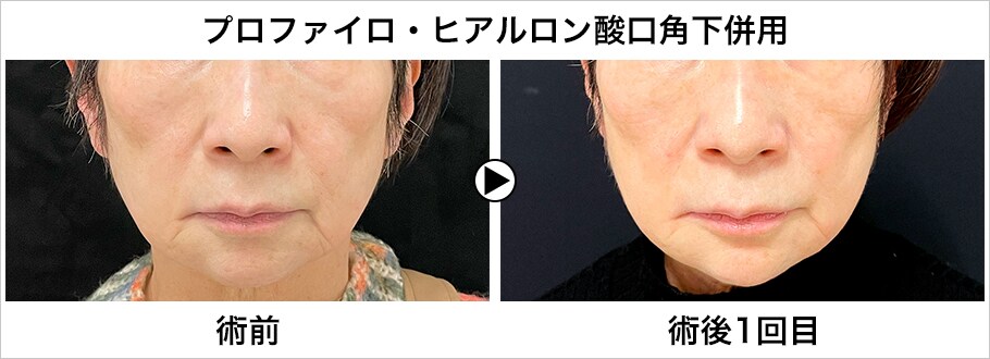 メイン下症例写真