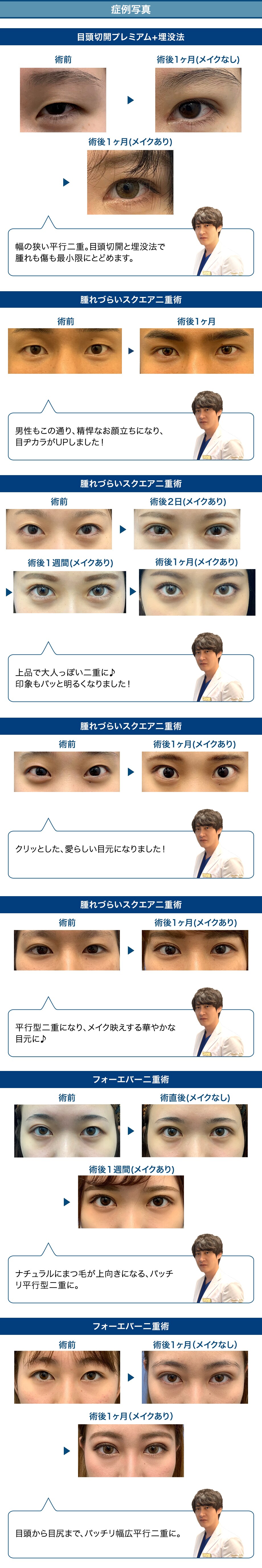 中谷dr の 究極の美的センス で生み出 二重 二重整形モニター募集 美容整形 美容外科の湘南美容クリニック