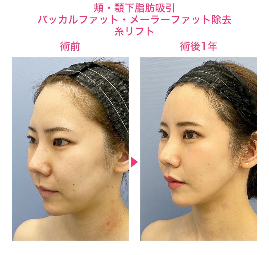 ピックアップ症例写真