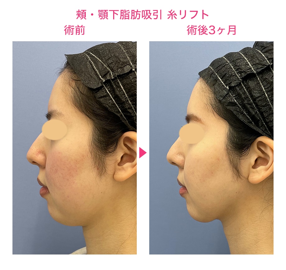 ピックアップ症例写真