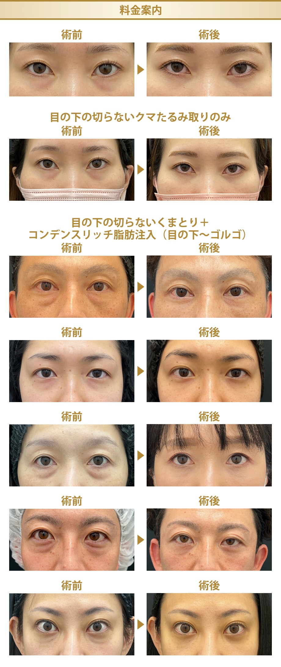 料金下症例写真