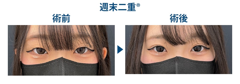 ピックアップ症例写真