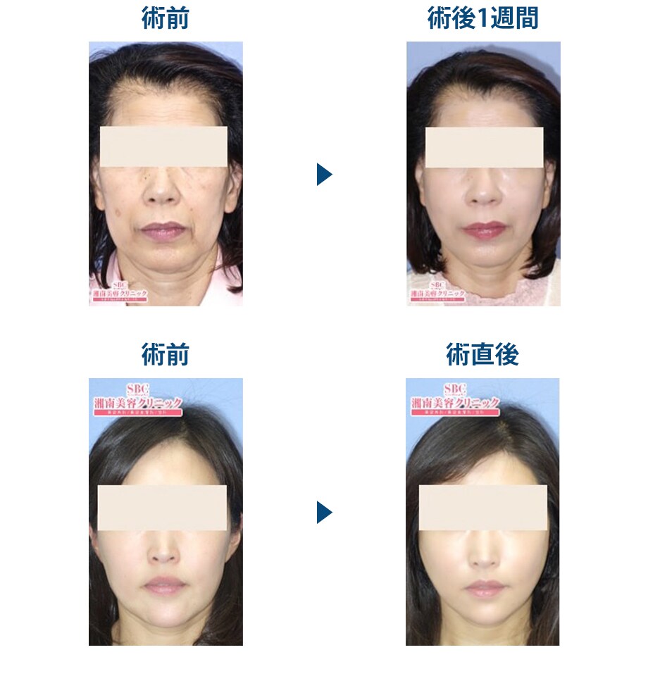 ピックアップ症例写真