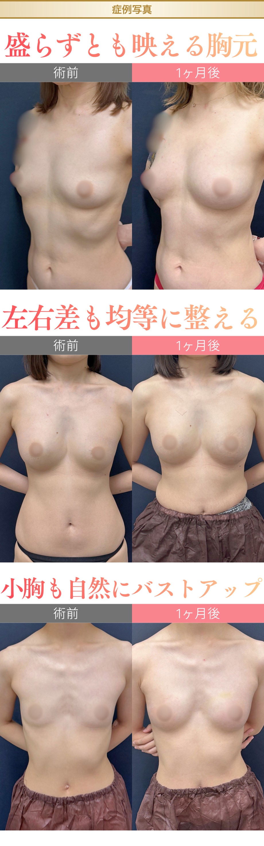 料金下症例写真