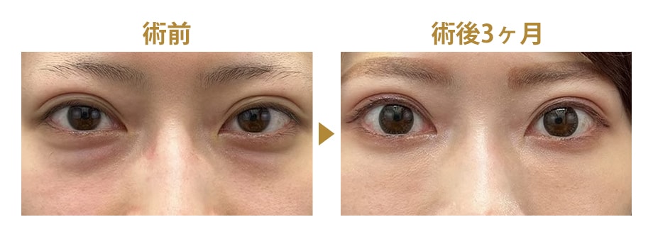 料金下症例写真