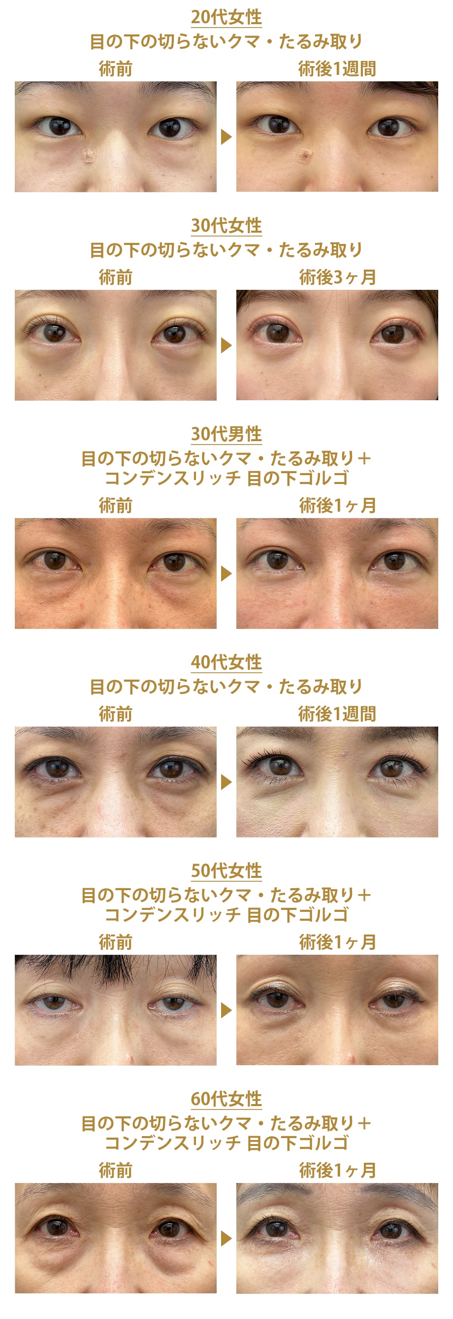 料金下症例写真