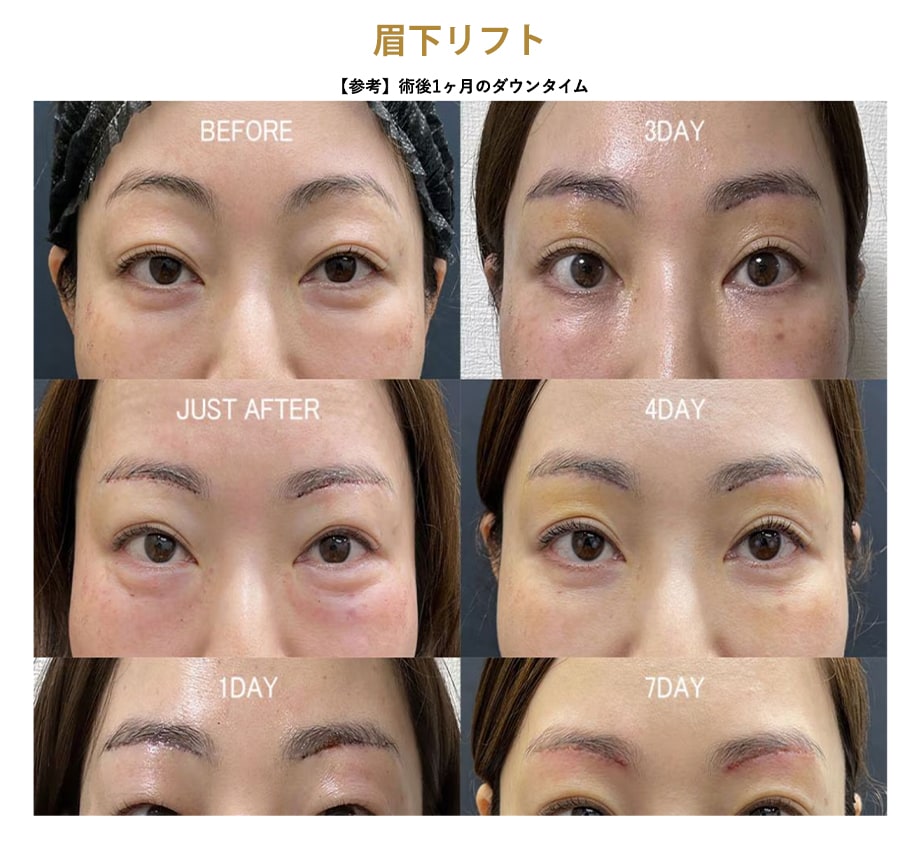 料金下症例写真